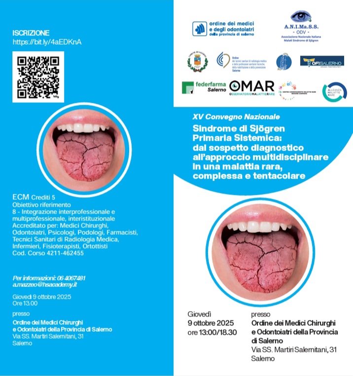 Sindrome di Sjogren Primaria Sistemica: dal sospetto diagnostico all’ approccio multidisciplinare in una malattia rara, complessa e tentacolare